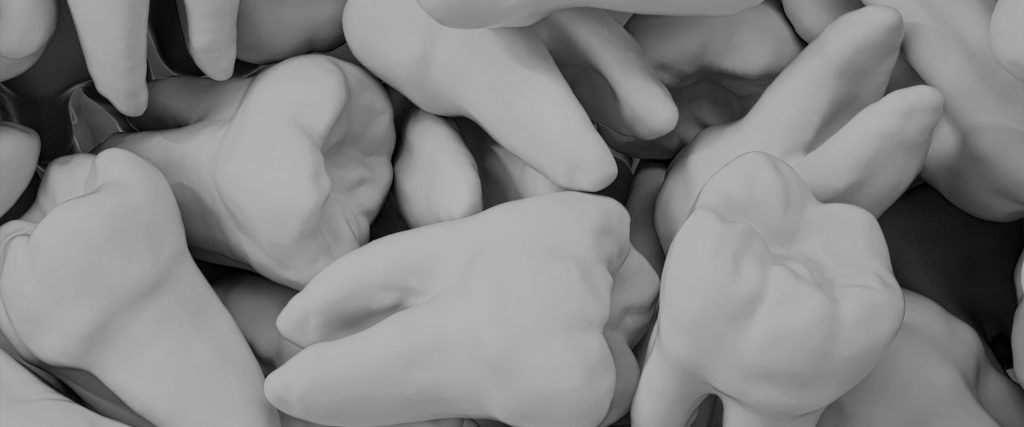 Read more about the article Removable Implants vs Fixed Implants: Which is Right for You?