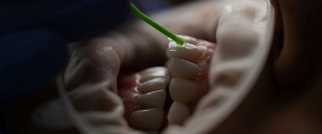 Read more about the article How Dental Technicians Do Smile Designs Uniquely Based on Each Individual